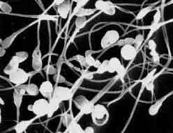 spermatozoïde